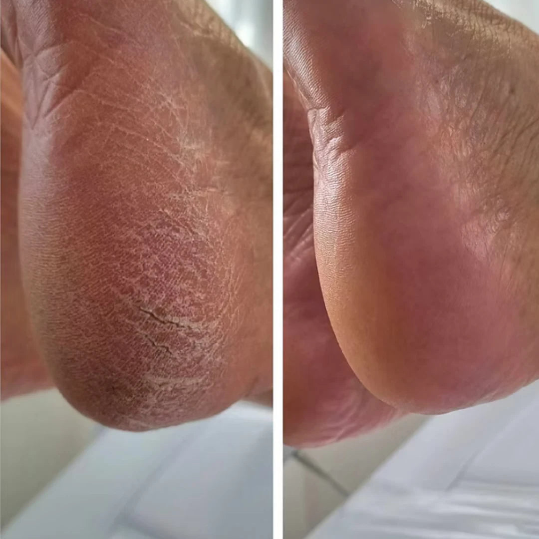 NanoGlass Foot File | Callus Remover